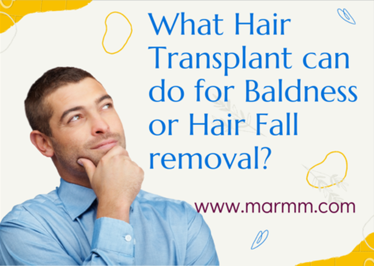 Hair transplant in Indore